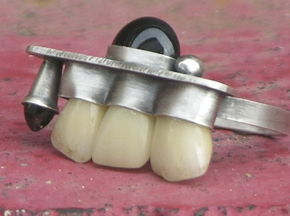 Over Bite Teeth Ring Made With Vintage Fake Teeth Garnet Onyx
